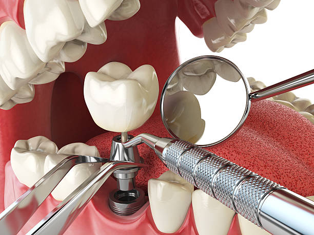 Best Emergency Dentist for Special Needs Patients in Panama, OK